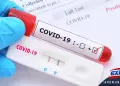 Los anticuerpos contra el covid-19 permanecerían en la sangre al menos ocho meses
