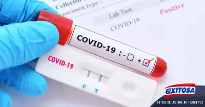 covid-19-anticuerpos-sangre
