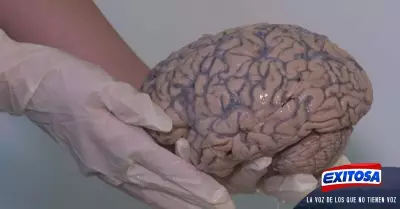 cerebro-materia-gris