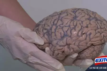 cerebro-materia-gris