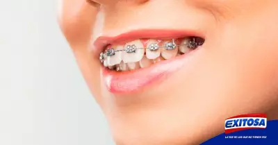 claves-brackets-Exitosa
