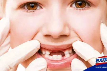 maloclusion-dental-malformacion-senales-Exitosa
