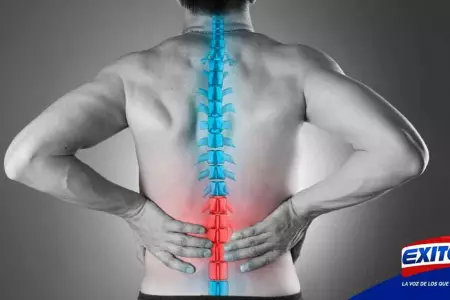 ciatica-dolor-columna-vertebral-exitosa
