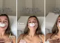 Mujer se hace rinoplastia para que sus "hijos tengan bonita nariz"