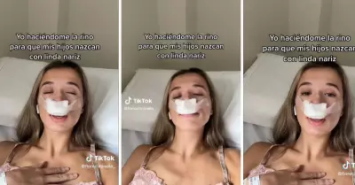 Mujer se hace rinoplastia para que sus "hijos tengan bonita nariz"