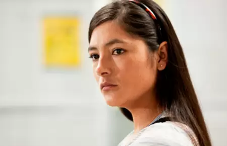 Magaly Solier requerira de implante de titanio en maxilar.