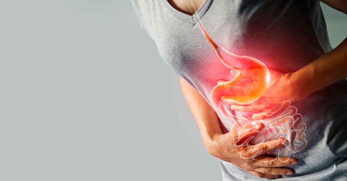 Afecciones oncológicas: Conoce las razones por el que los casos cáncer de colon van en aumento en personas jóvenes