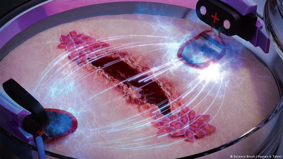 Científicos crean biochip que podría curar heridas tres veces más rápido con electricidad