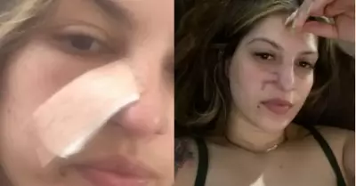 Mujer de 27 aos descubre que padece cncer al realizarse un tratamiento facial.