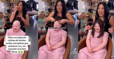 Nia con alopecia se ve con peluca por primera vez y su reaccin se vuelve viral