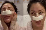 Sheyla Rojas revela que se volvi a operar la nariz: "Me siento muy contenta"