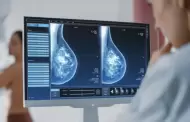 Cncer de mama en Per: Deteccin temprana y los tratamientos personalizados elevan la supervivencia hasta el 90%