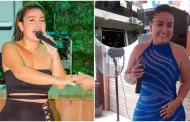 Fallece cantante y obstetra Yuliana Perea tras una liposucción en clínica de Iquitos