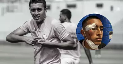 Fabrizio Roca, futbolista de Sport Boys, fue agredido por barristas.