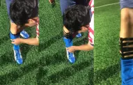Qu llevas en la pierna? Deportista sorprende con la forma 'inusual' de protegerse durante un partido de ftbol