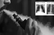 Atencin! INEN advierte que usar cigarrillos electrnicos aumentara riesgo de cncer de pulmn