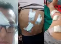 Delincuentes venezolanos atacan a poblador y lo dejan grave en hospital