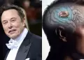Revolucin! Elon Musk promete restaurar la vista gracias a Blindsight, la innovacin de Neuralink