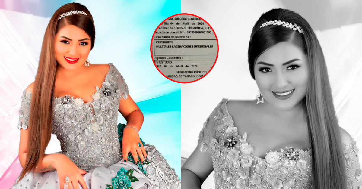 Muñequita Milly: ¡Impactante! Revelan resultado de necropsia de cantante operada por el Dr. Fong - Exitosa Noticias