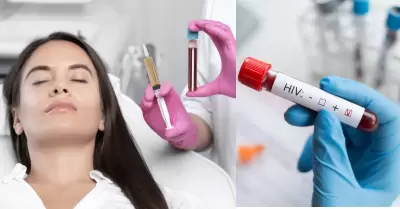 3 mujeres resultan infectadas con VIH por 'vampiro facial'