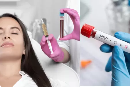 3 mujeres resultan infectadas con VIH por 'vampiro facial'