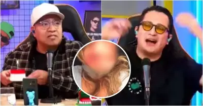 Youtubers celebran crticas por burlarse del dedo cortado de empresaria