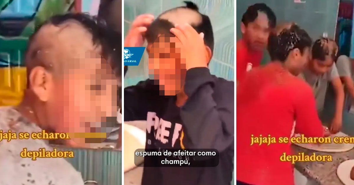 ¡travesura Fuera De Control Niños Confunden Crema Depilatoria Con Shampoo Y Terminan Calvos 1386