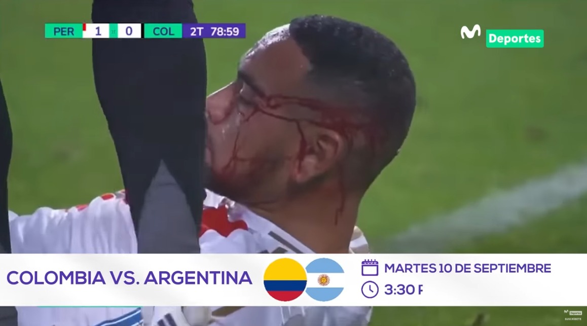Alexander Callens sufre fuerte golpe durante Perú vs. Colombia .