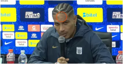 Paolo Guerrero y su herida en su regreso a Alianza Lima