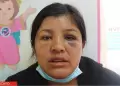 Urgente! Nia debe ser trasladada de Huancayo a Lima tras perder su brazo en accidente