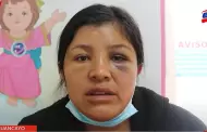 Urgente! Nia debe ser trasladada de Huancayo a Lima tras perder su brazo en accidente