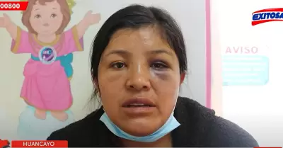 La madre de una nia de 7 aos pide ayuda para que la menor sea trasladada a Lim