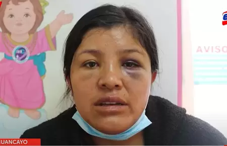 La madre de una nia de 7 aos pide ayuda para que la menor sea trasladada a Lim