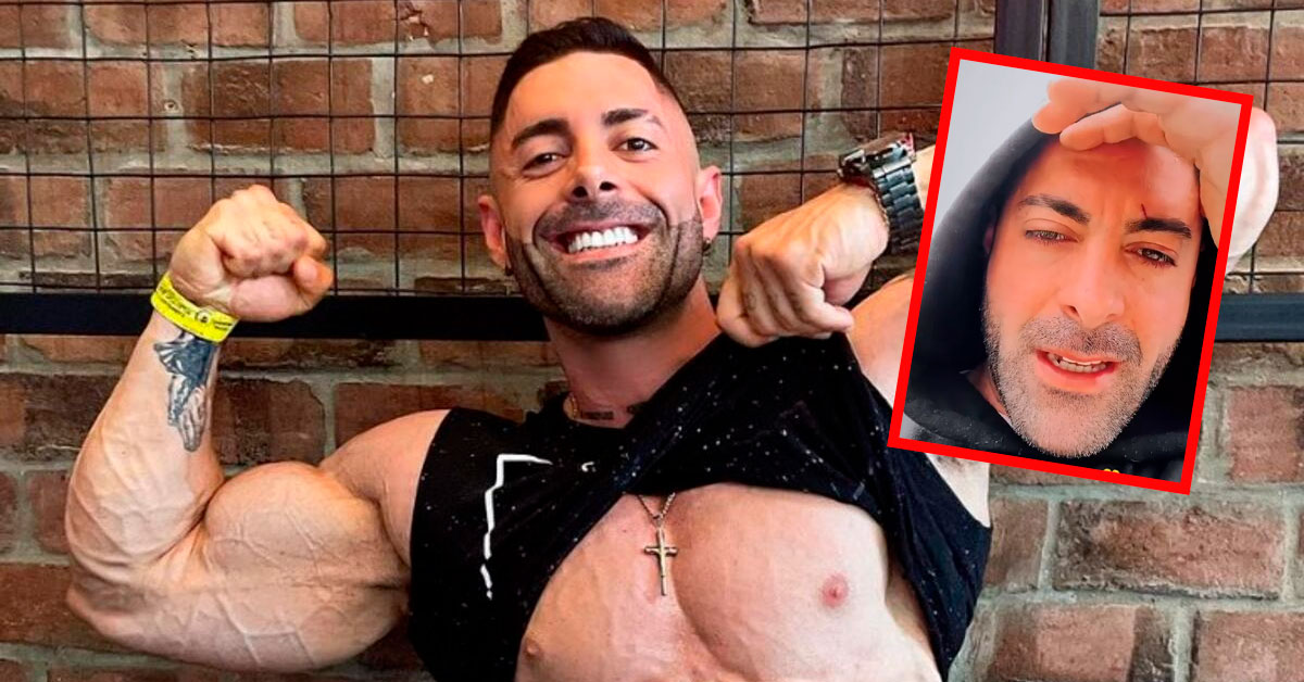 Sebastián Lizarzaburu preocupa a sus seguidores tras reaparecer con cicatrices en su rostro ¿Qué le pasó?