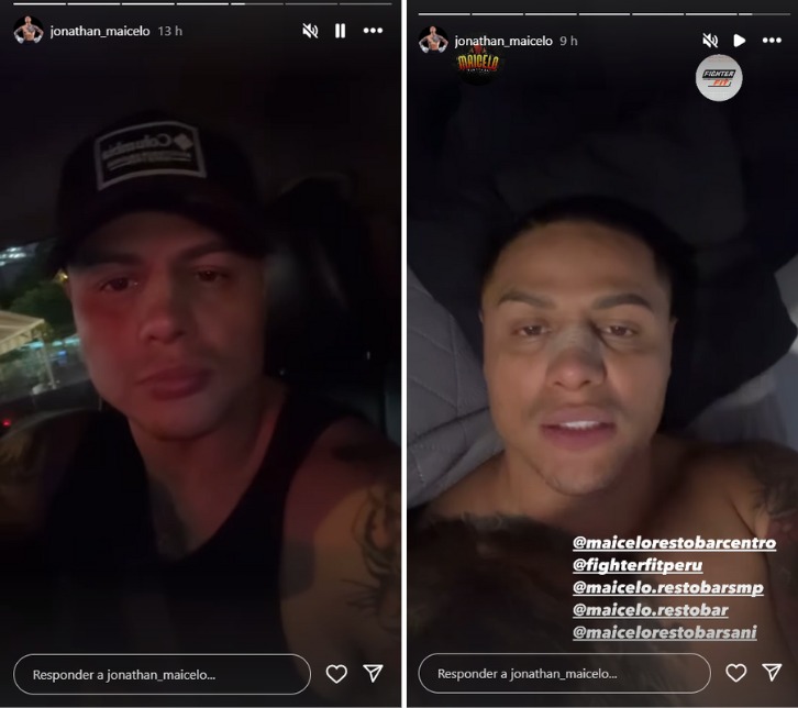 Jonathan Maicelo sorprende con su nueva imagen.