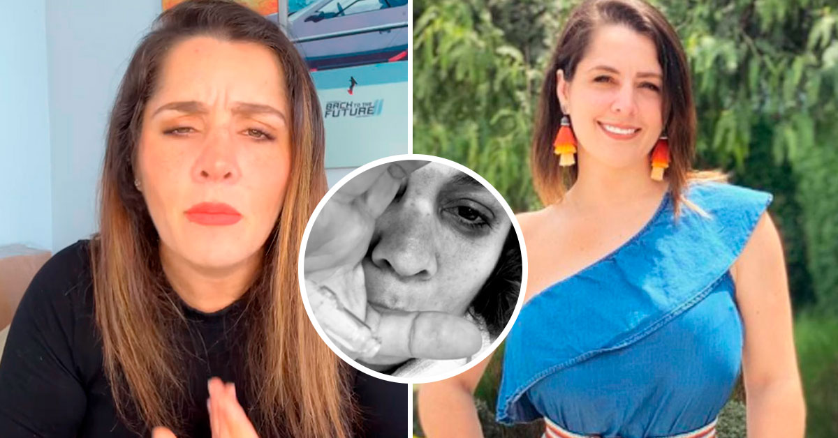 Yiddá Eslava preocupa a sus fans tras sufrir terrible accidente en el rostro: "En pleno rodaje"