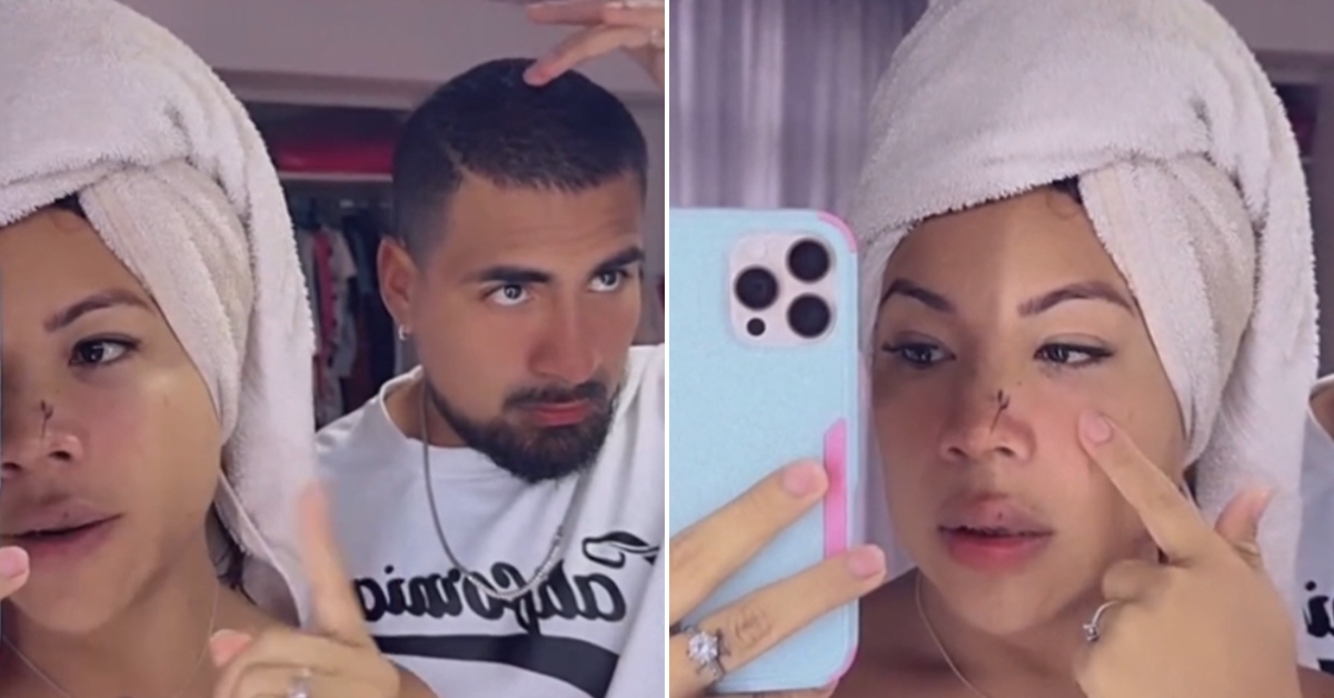 Dayanita responde a rumores y aclara que las lesiones en su cara no fueron provocadas por su novio