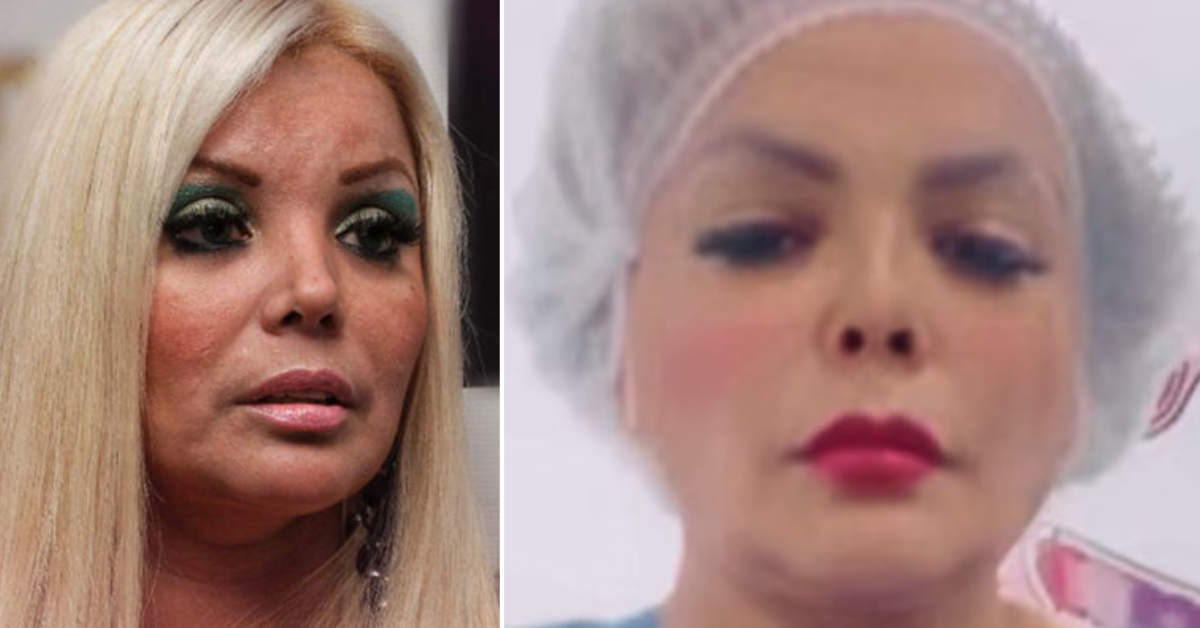 Shirley Cherres preocupa por su estado de salud tras someterse a la manga gástrica: "Tengo miedo"