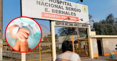 Beb habra sufrido quemaduras en hospital Sergio Bernales.