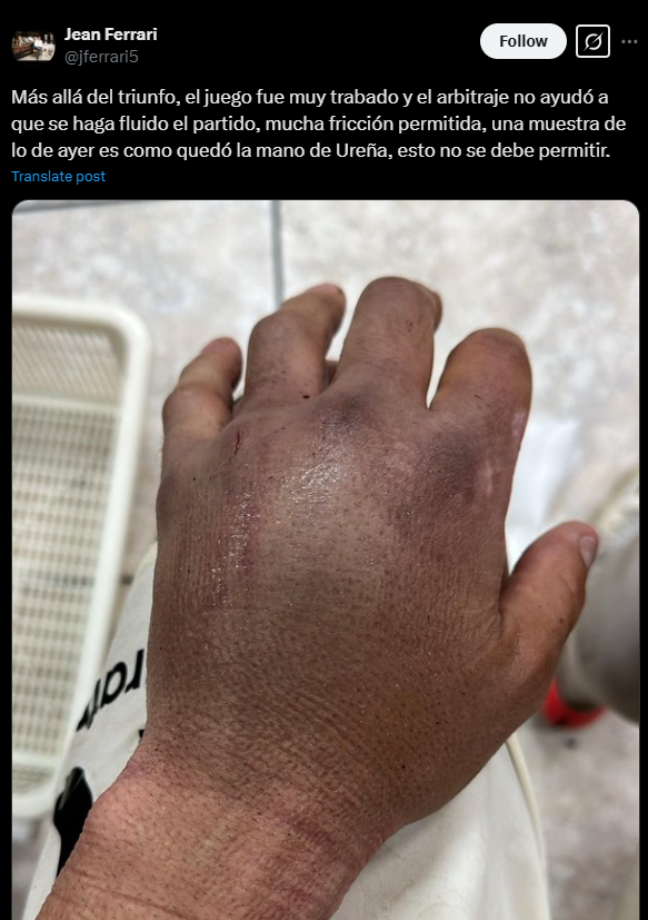 As qued la mano izquierda de Urea por un pisotn.