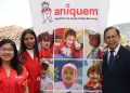 Aniquem contar con nuevas reas de atencin en Cusco para brindar rehabilitacin a nios sobrevivientes de quemaduras