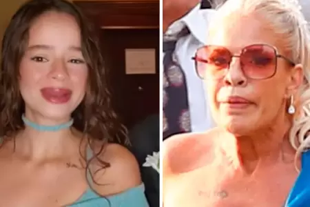 Vernica Alcal tras agresin de su hija Thamara Medina.