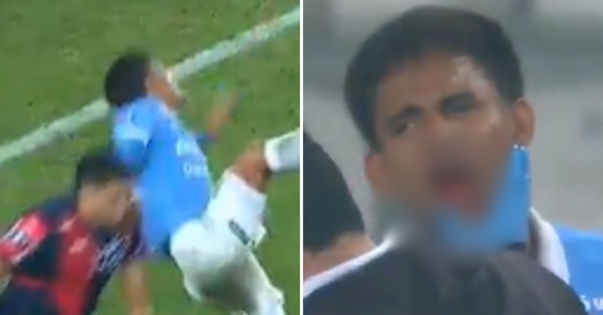 Jhilmar Lora pierde un diente tras brutal codazo en el Sporting Cristal vs Cerro Porteño