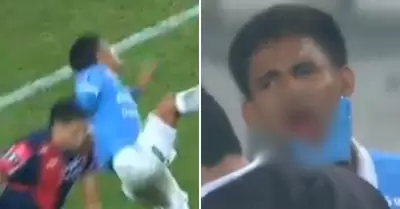 Jhilmar Lora pierde un diente