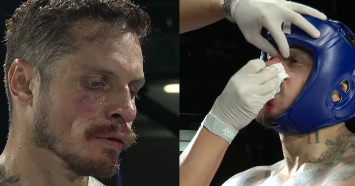 Así terminó el rostro de Nico Ponce.