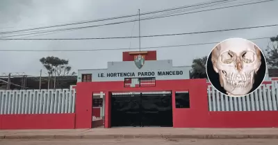 Escolar sufre fractura de mandíbula en el colegio de Chala