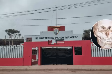 Escolar sufre fractura de mandbula en el colegio de Chala