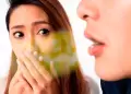 ¿Cómo reducir el mal aliento en la mañana?: Consejos de odontólogos para afrontar la halitosis