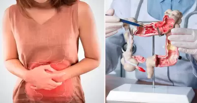 Licuado potente para limpiar el colon.