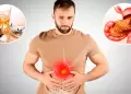 Sufres de pancreatitis? Estos ALIMENTOS comunes podran estar daando tu SALUD sin que lo notes